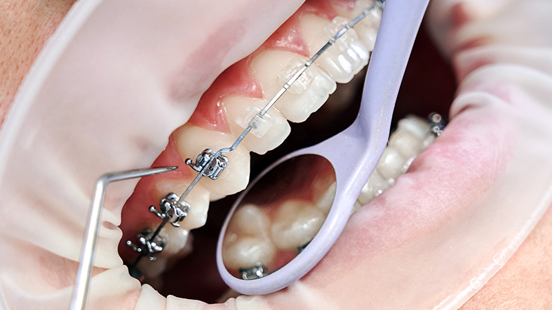 Appareil multiattache