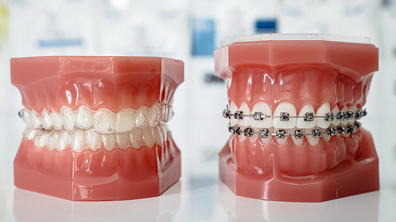 Aligneur et multiattache