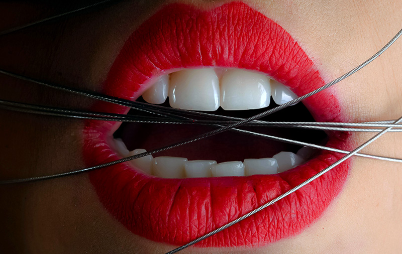 Une bouche avec des fils métalliques